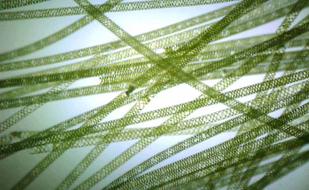 Spirogyras-green-algae-chloroplasts.jpg